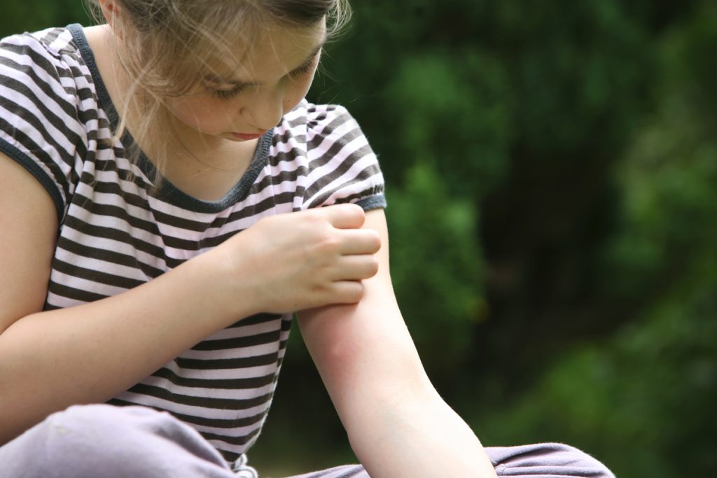 Dos & Don'ts for Bug Bites with Kids - SavvyMom