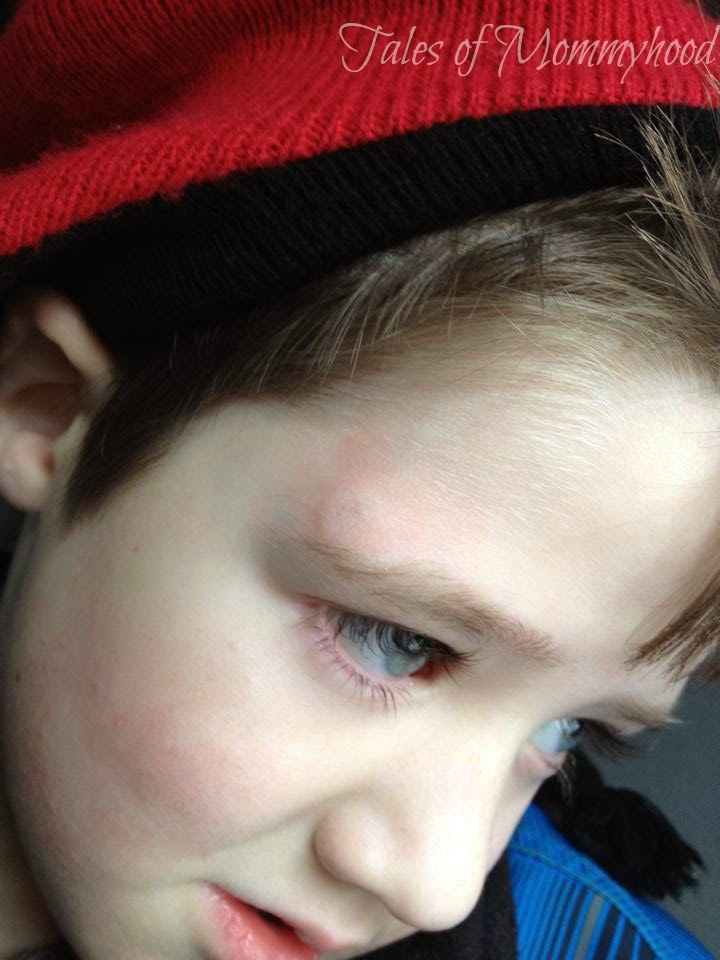 headinjury headinjury