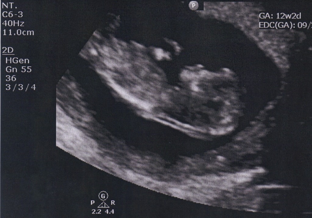 Baby-3-12-weeks