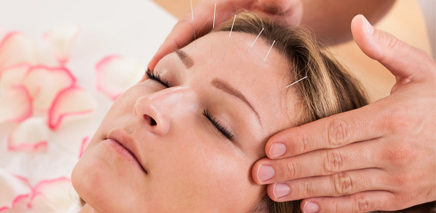 acupuncture at Johal Health Centre