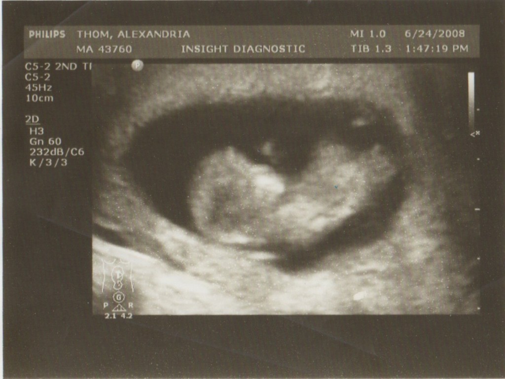 ultrasound-e1344550575726-1024x769