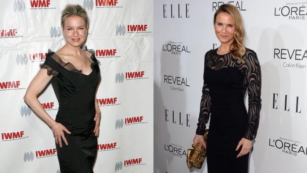 Renee-Zellweger-plastic-surgery Renee-Zellweger-plastic-surgery