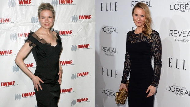 Renee-Zellweger-plastic-surgery