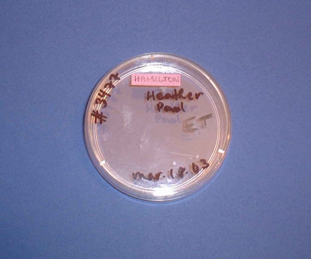 embryo2Bdish-2Bty27s2Bfirst2Bhome-zoom embryo2Bdish-2Bty27s2Bfirst2Bhome-zoom