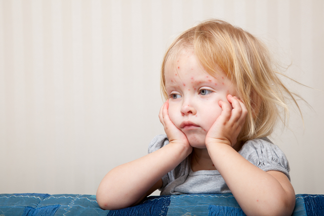 measles_girl measles_girl