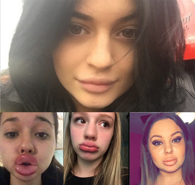 kylie-jenner-examples kylie-jenner-examples