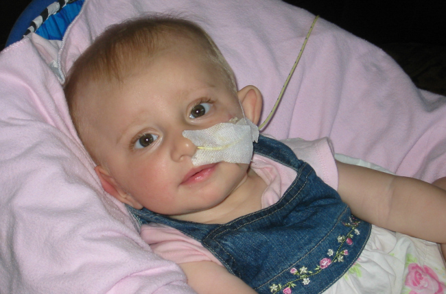 baby_nasogastric_feeding_tube