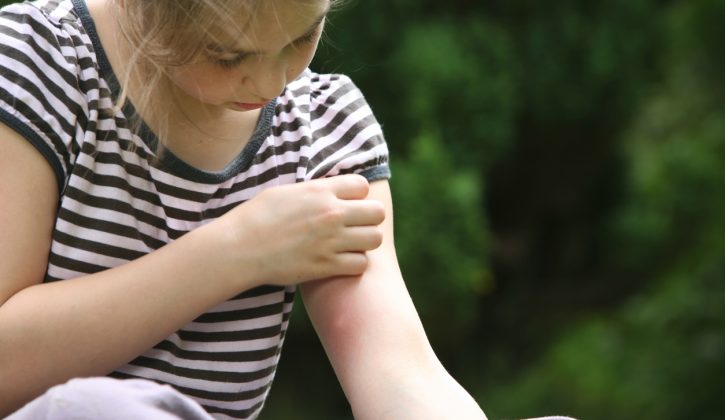 Dos & Don'ts for Bug Bites with Kids - SavvyMom