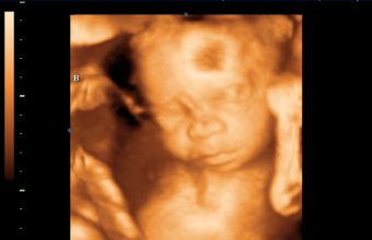 UC2BBABY_2