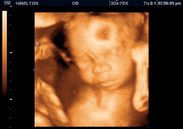 UC2BBABY_2