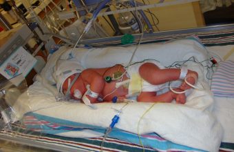 Nicu17