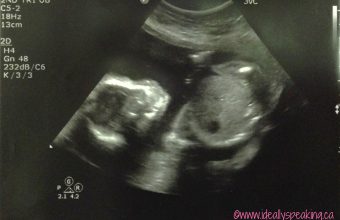 Ultrasound-Its-A-Boy