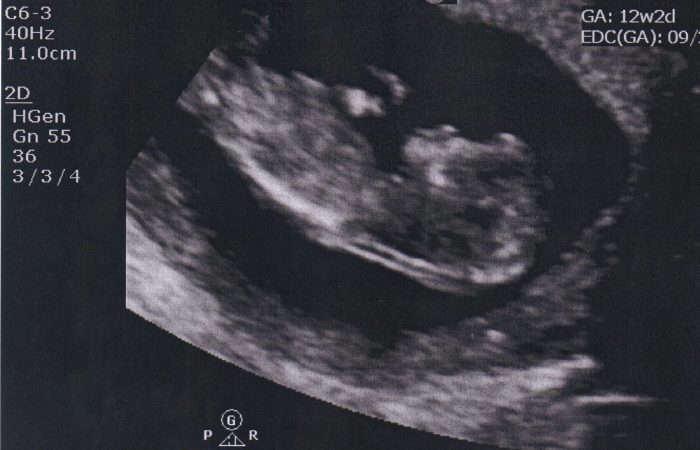 Baby-3-12-weeks