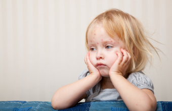 measles_girl