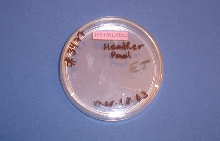embryo2Bdish-2Bty27s2Bfirst2Bhome-zoom-1